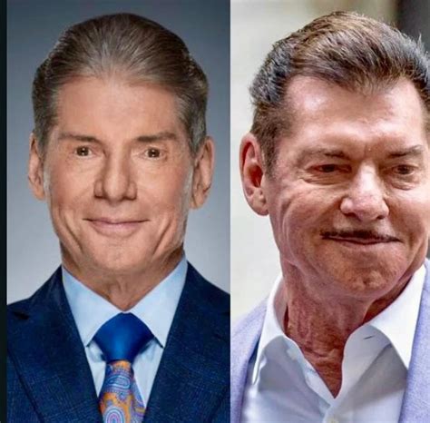 mc mahon|what happened to vince mcmahon's face.